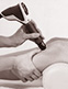 Shockwave Therapy